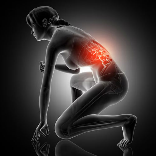 Ankylosing-Spondylitis